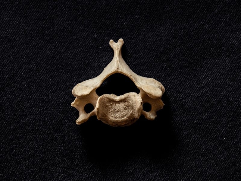 Vértebra cervical sobre fondo oscuro — investigación en estimulación medular