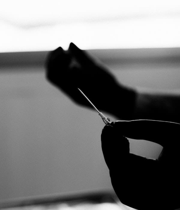 Manos enguantadas en un procedimiento intervencionista de dolor